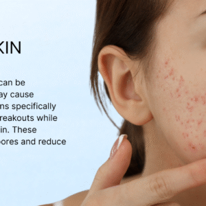 Acne-Prone and Blemished Skin
